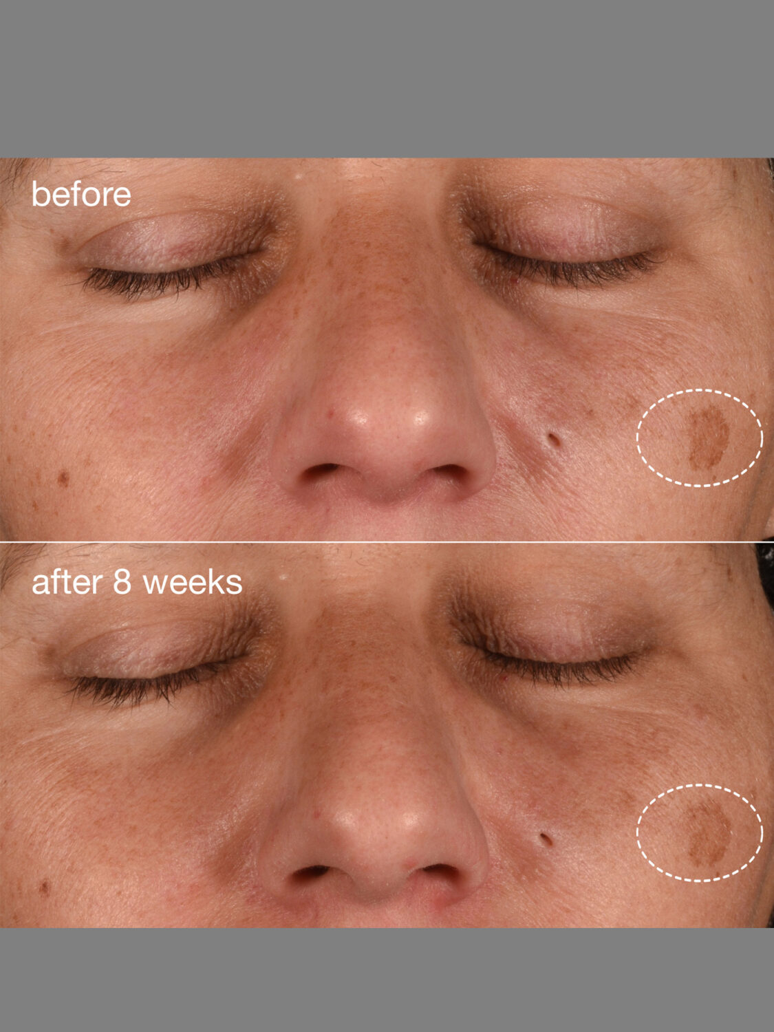 1392x1856_ dynamic-skin-recovery-spf50_ba